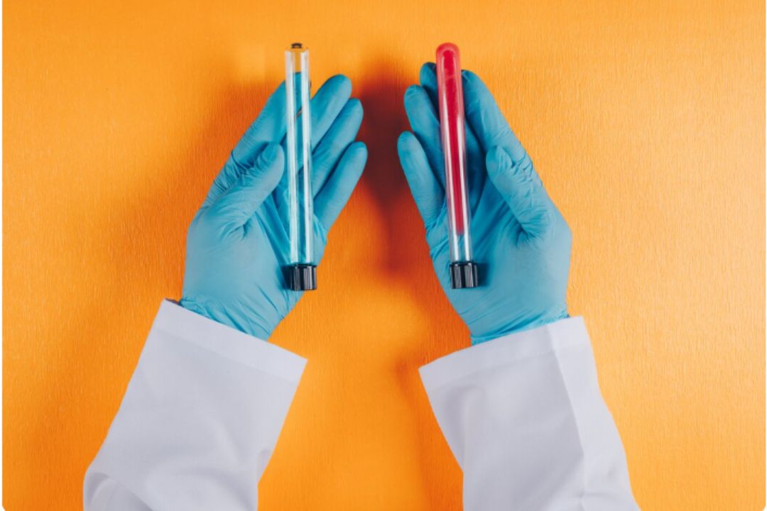 AMH Test Vs FSH Test